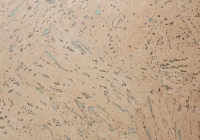 Пробковое покрытие Wicanders Corkcomfort Leather Aqua C84B001